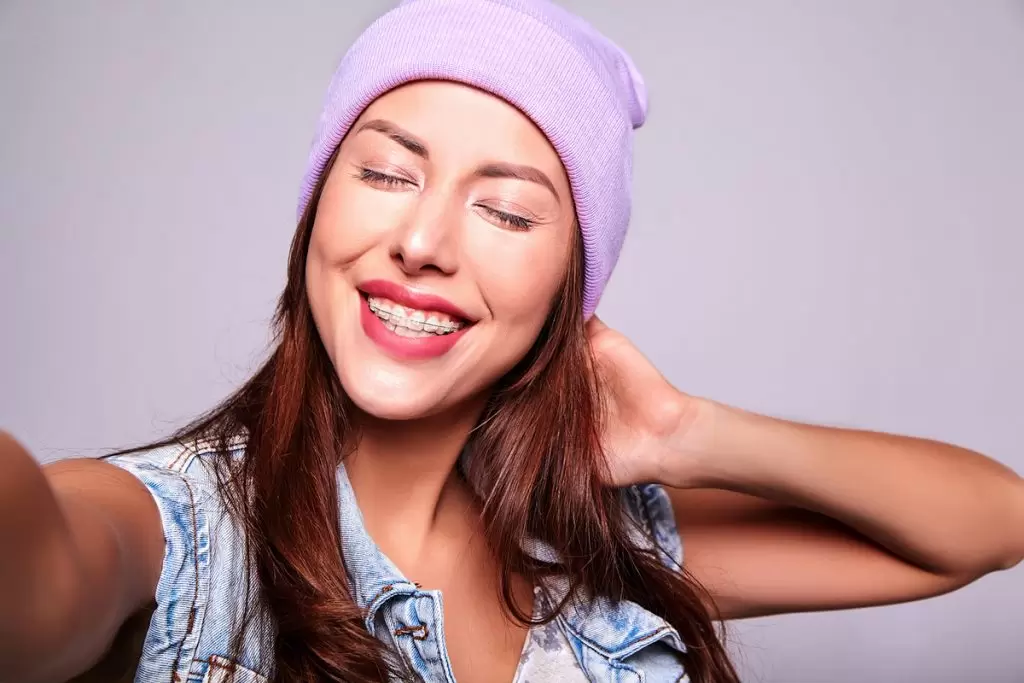 Топ-5 ошибок при уходе за зубами с брекетами