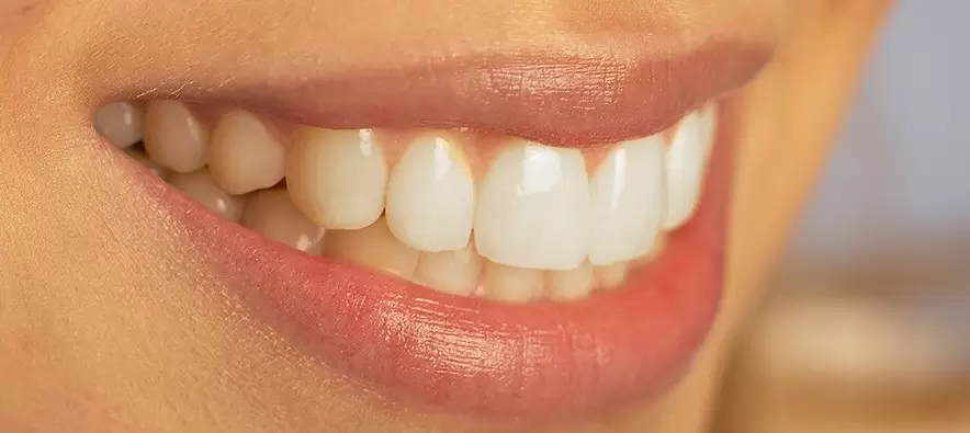 Как исправить неправильный прикус?