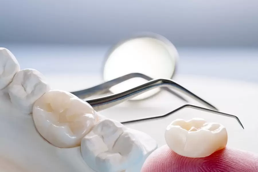 Рекомендации после проведения имплантации зубов