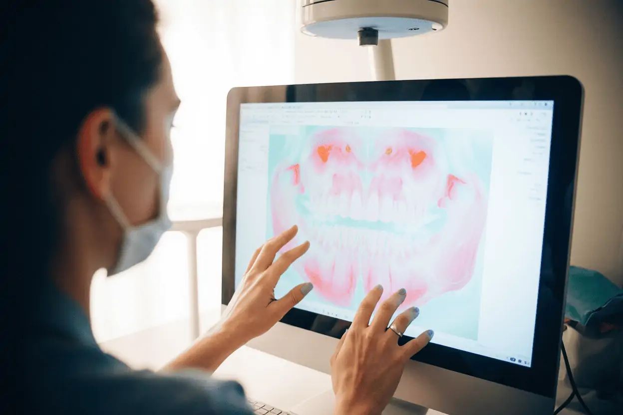 Костная пластика перед имплантацией: зачем нужна и можно ли обойтись без нее?