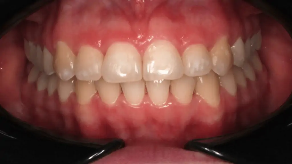 Портфолио - основное изображение