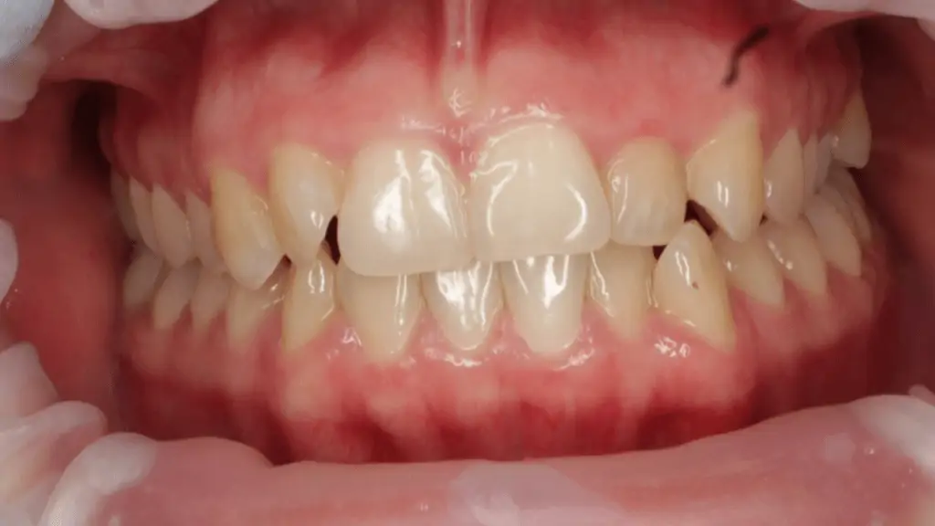 Портфолио - после 1