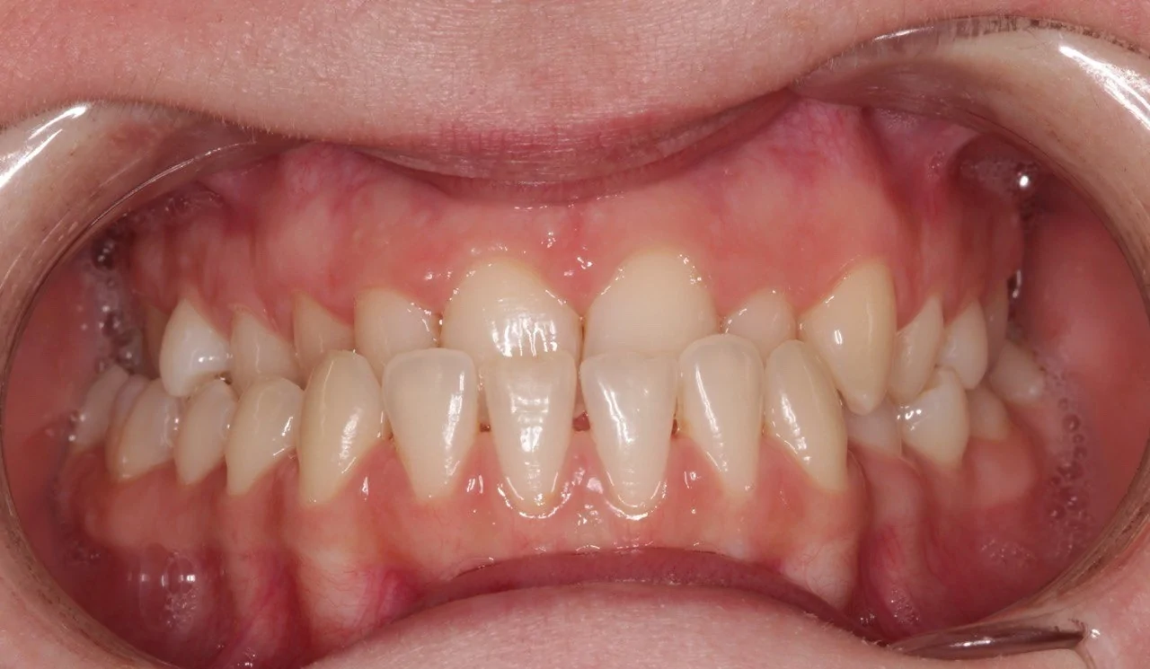 Портфолио - после 1