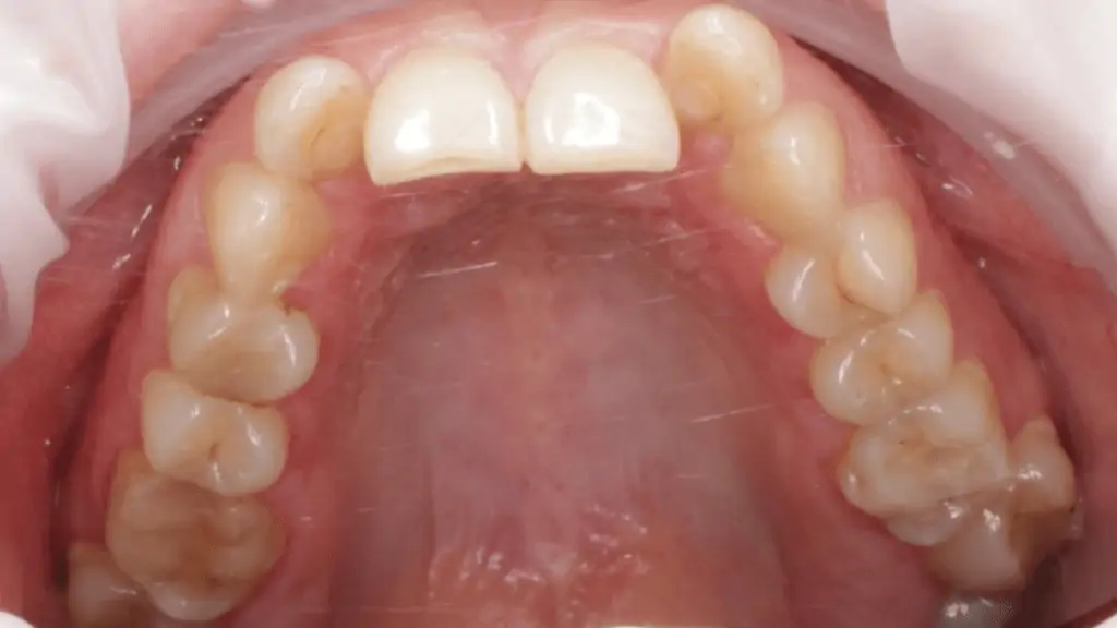 Портфолио - после 4