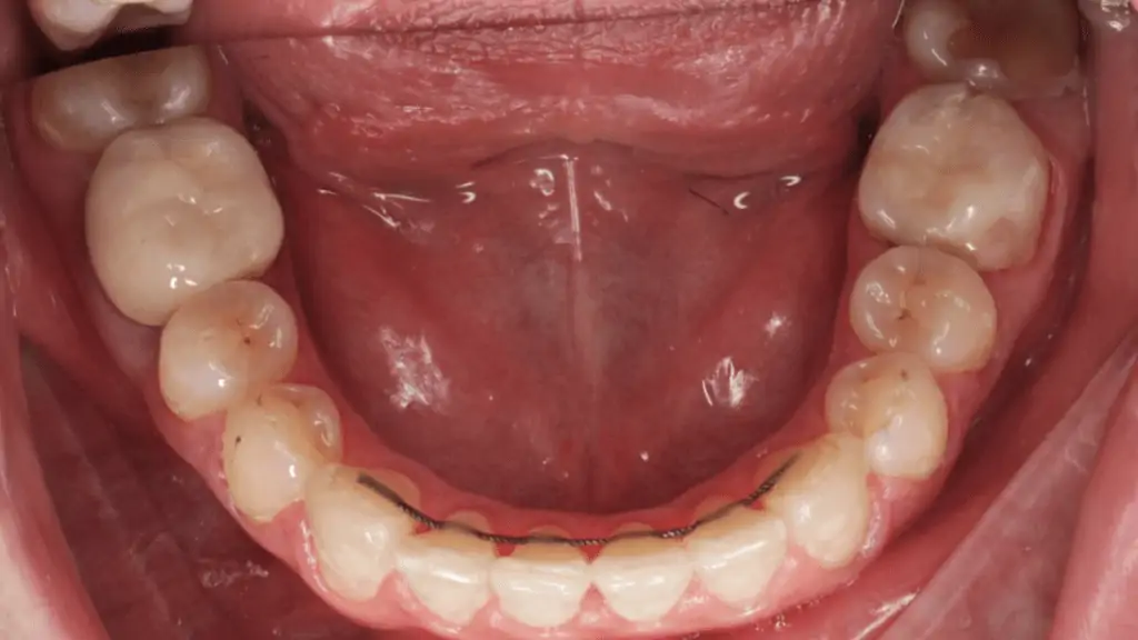 Портфолио - до 5