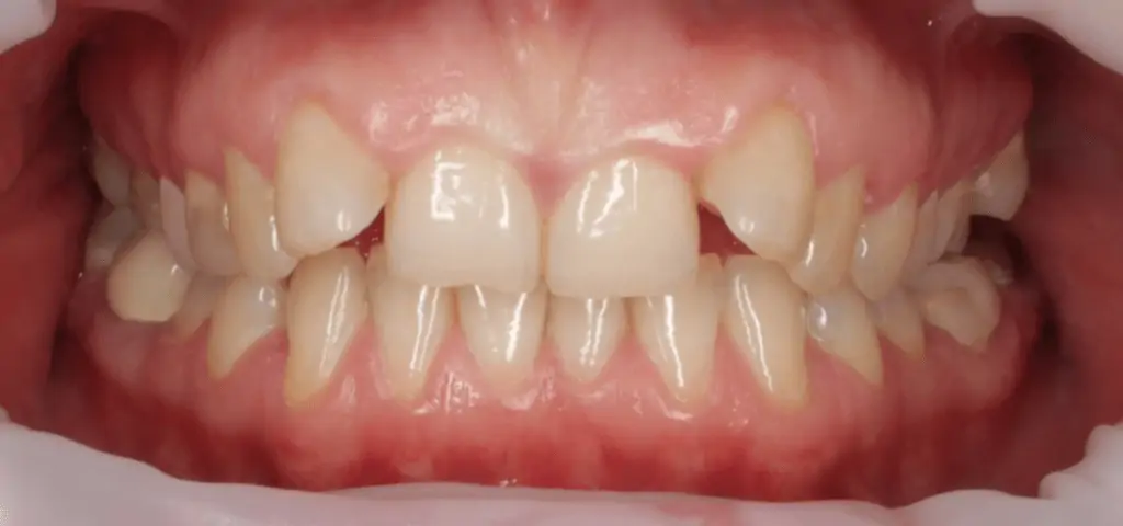 Портфолио - после 1