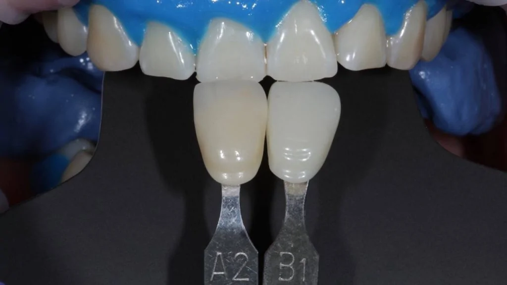 Портфолио - до 2