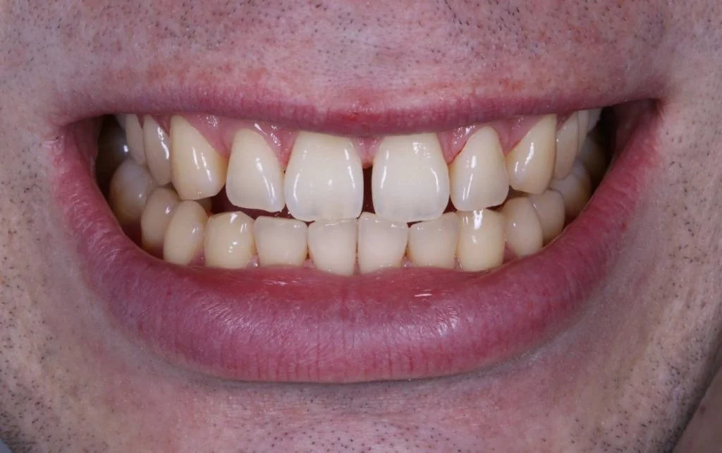 Портфолио - до 2