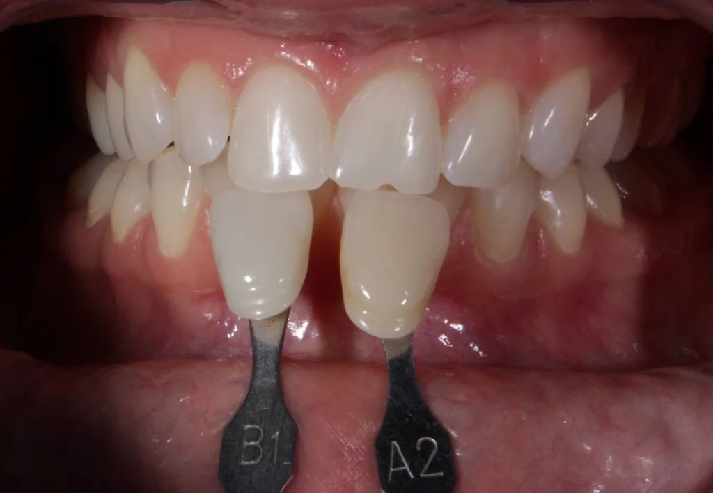 Портфолио - после 1