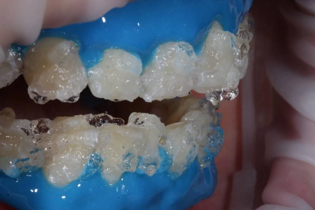 Портфолио - после 2