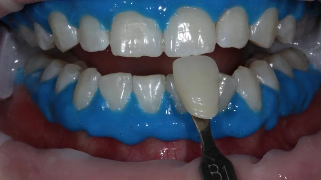 Портфолио - после 2