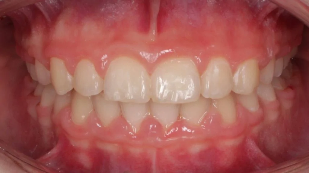 Портфолио - основное изображение