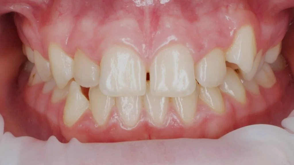 Портфолио - после 1