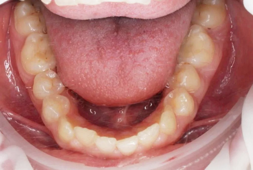 Портфолио - после 3