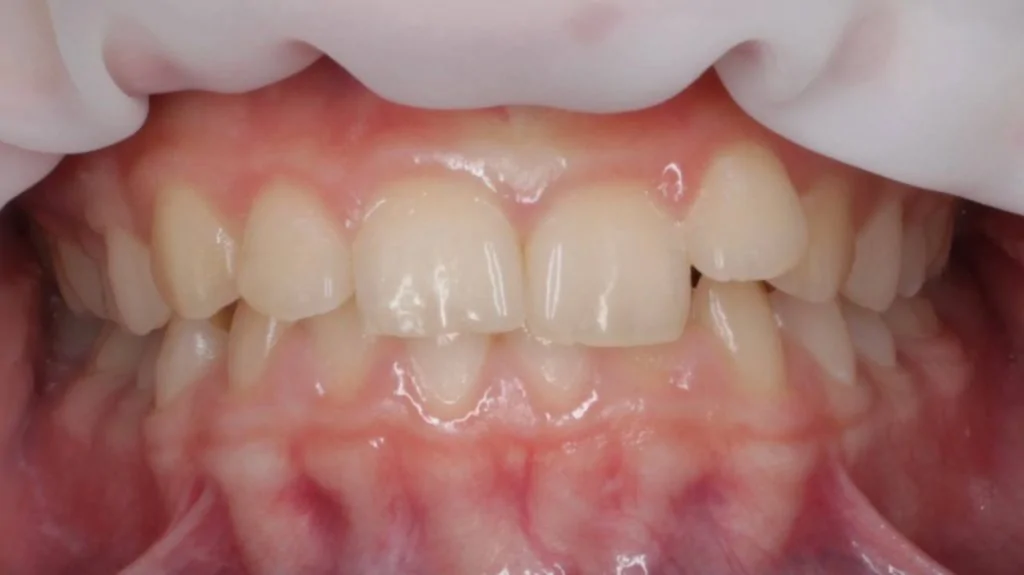 Портфолио - после 1