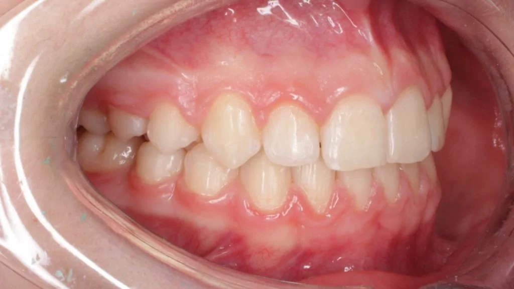 Портфолио - до 3