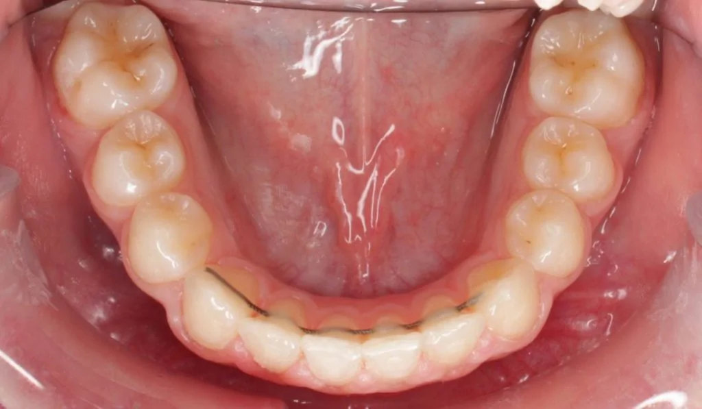 Портфолио - после 5