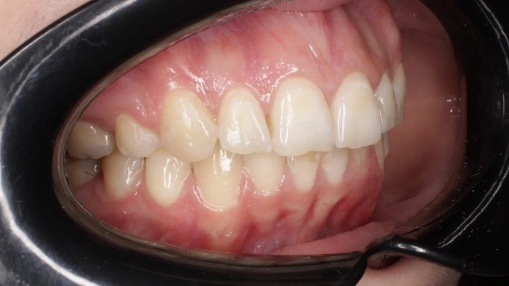 Портфолио - до 2