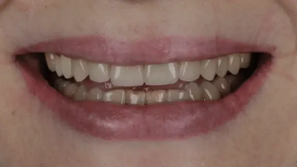 Портфолио - до 2