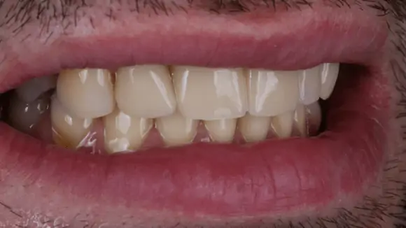 Портфолио - до 2