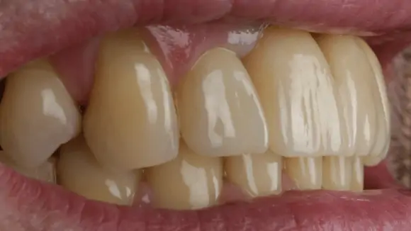 Портфолио - после 3