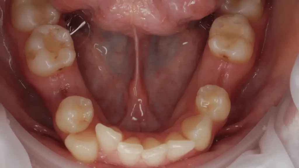 Портфолио - после 4