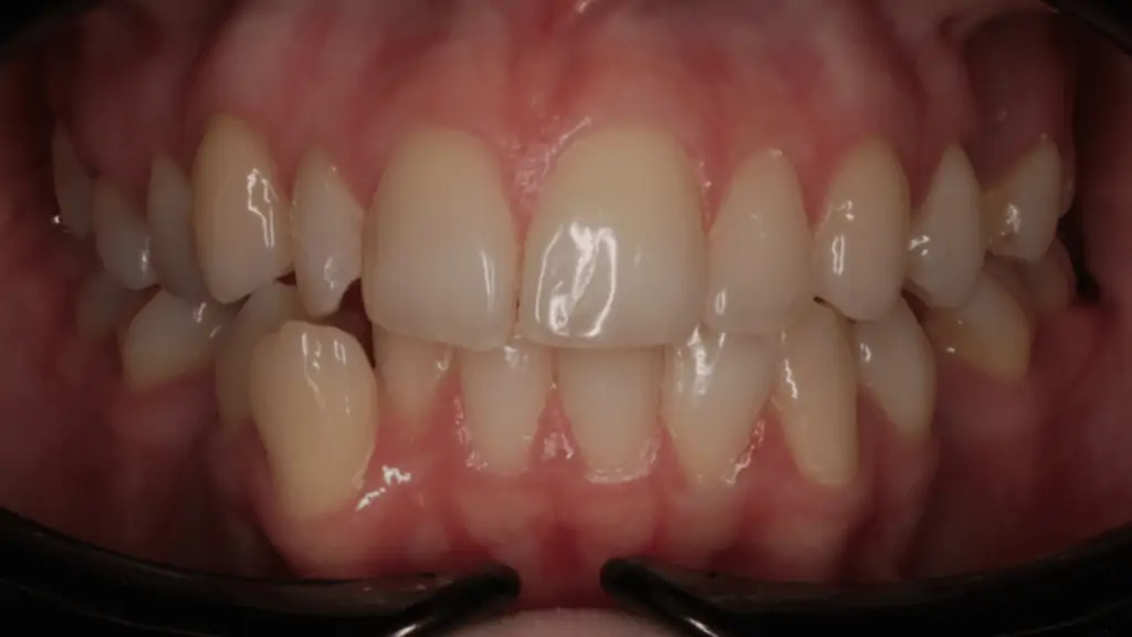 Портфолио - после 1