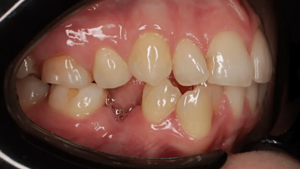 Портфолио - после 2