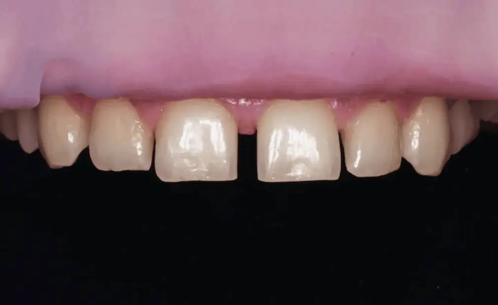 Портфолио - после 2