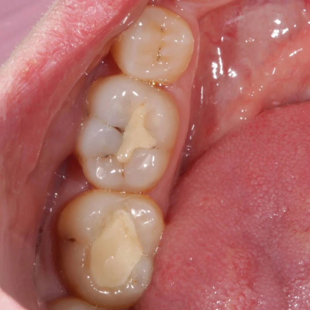 Портфолио - после 1