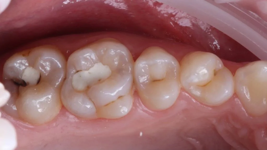 Портфолио - после 1