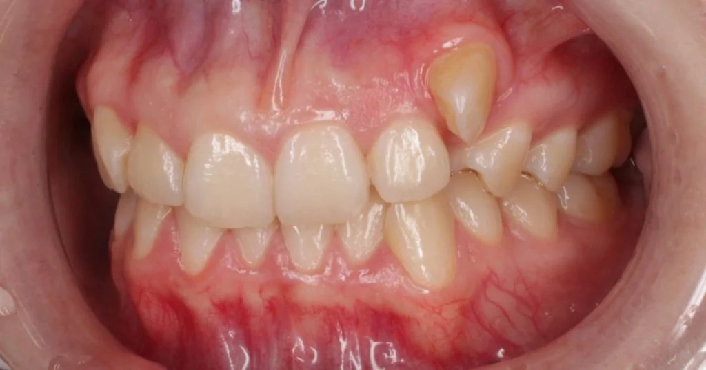 Портфолио - после 2