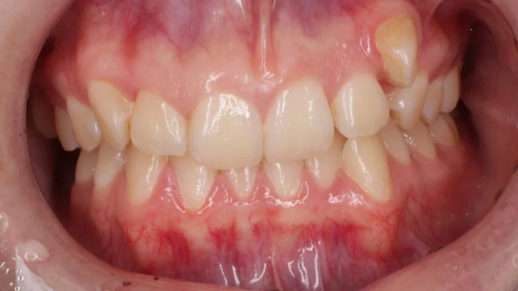 Портфолио - после 1