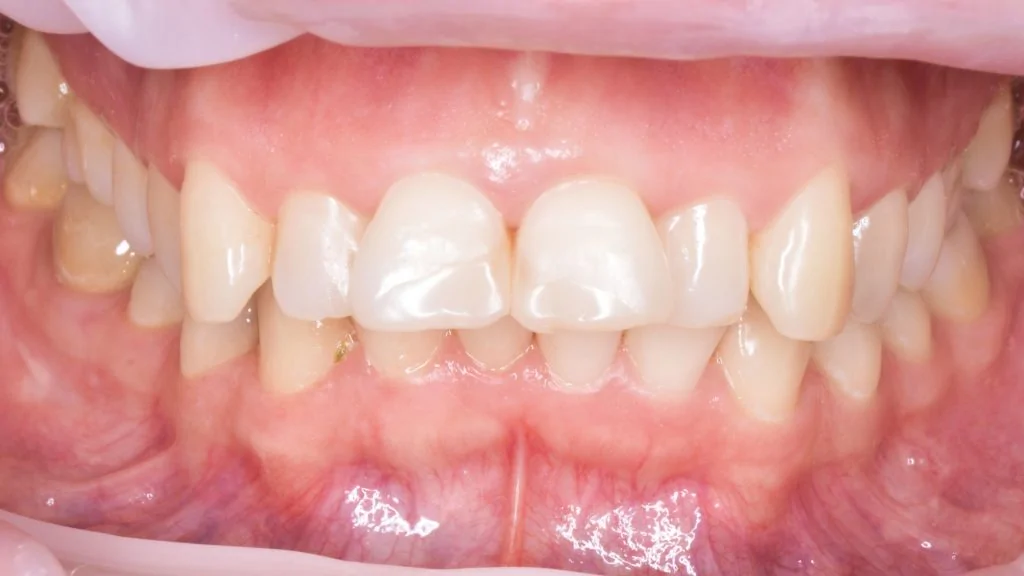 Портфолио - после 1