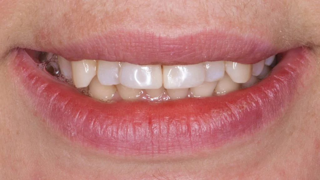 Портфолио - после 2