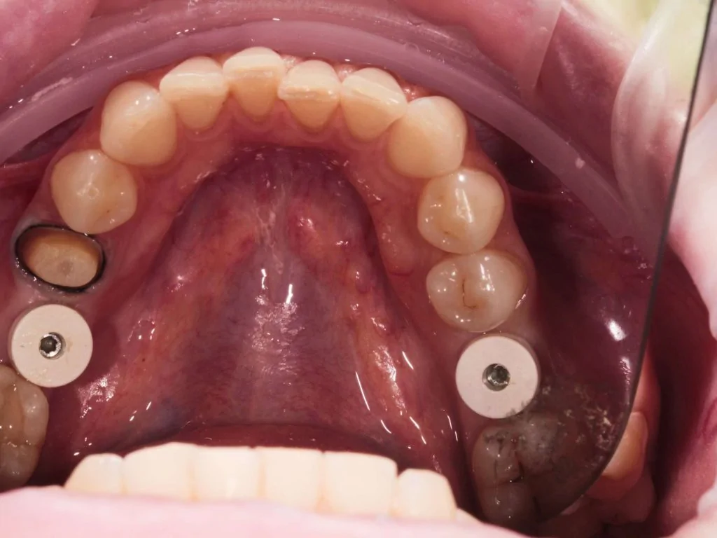 Портфолио - после 2