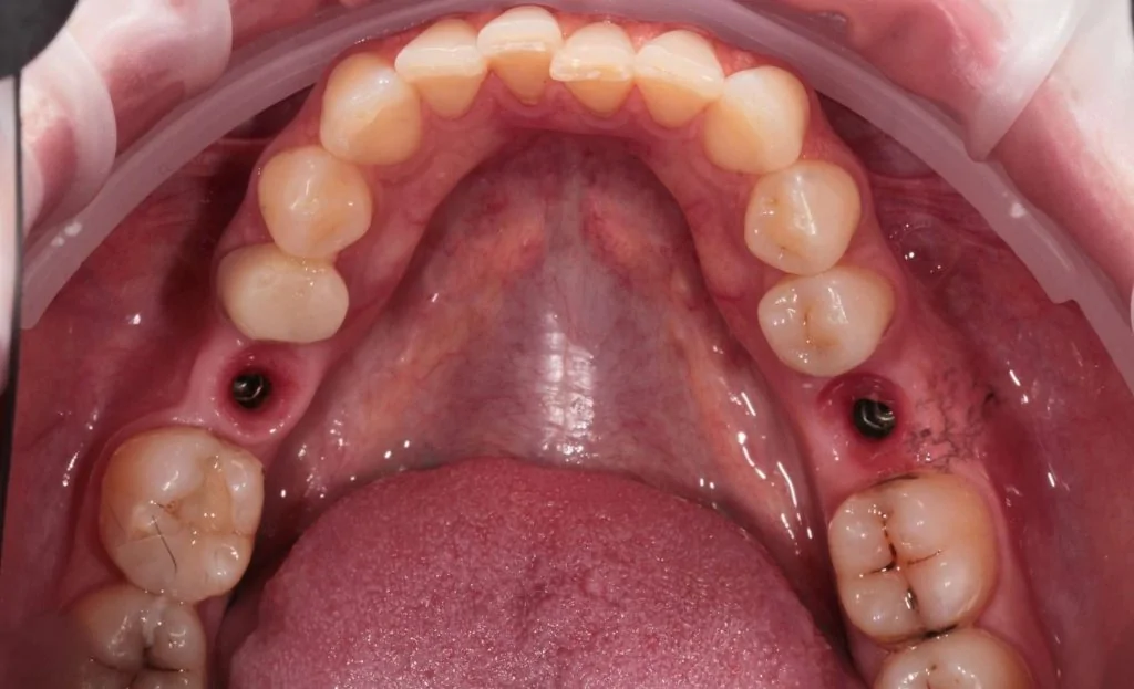 Портфолио - после 1