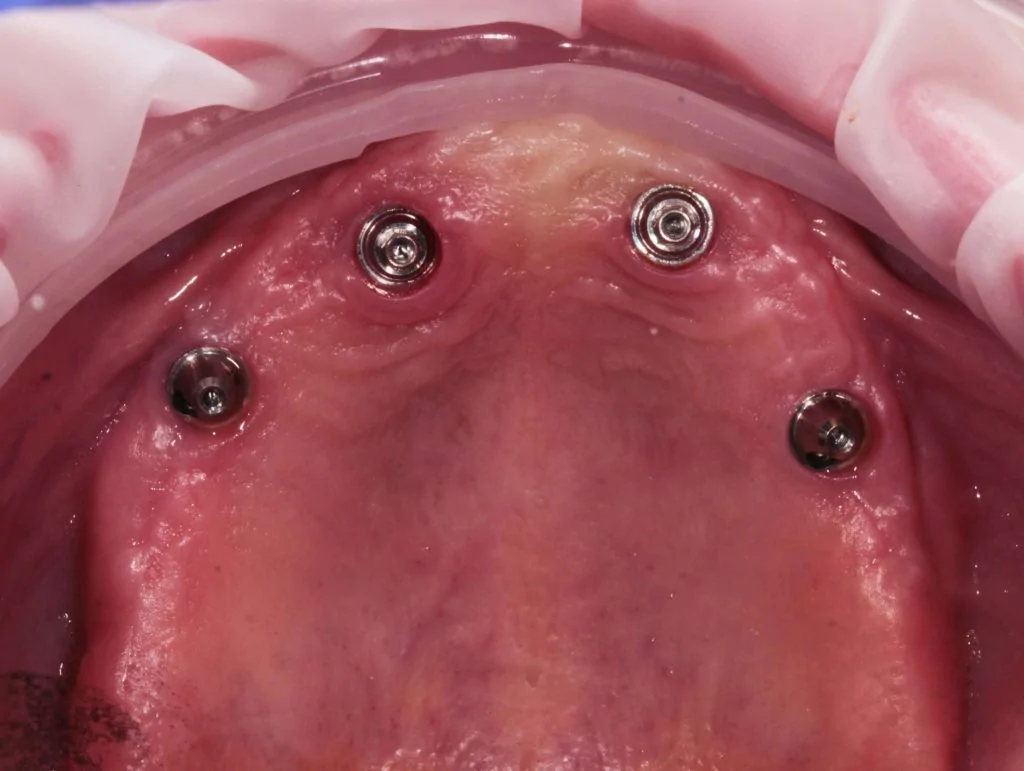 Портфолио - после 2