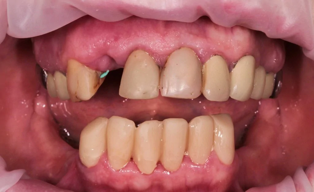 Портфолио - после 1