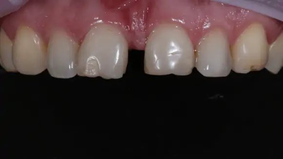 Портфолио - после 2