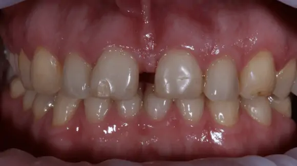 Портфолио - после 4