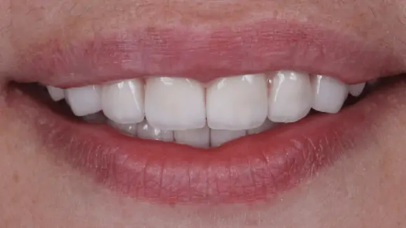 Портфолио - основное изображение