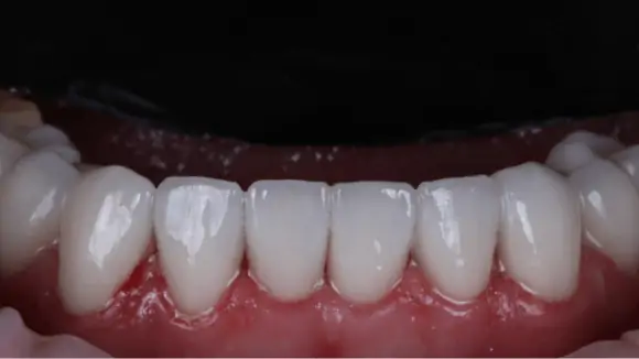 Портфолио - до 3