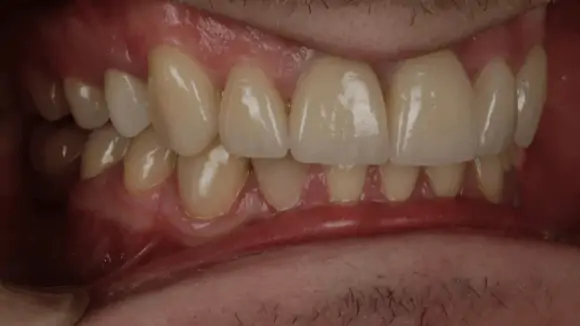 Портфолио - до 4