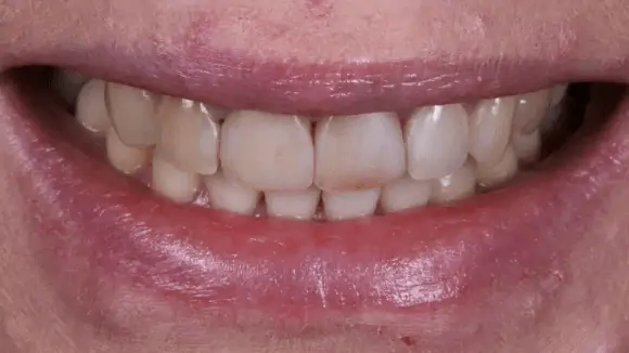 Портфолио - после 2