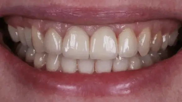 Портфолио - до 2