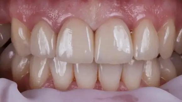 Портфолио - до 3