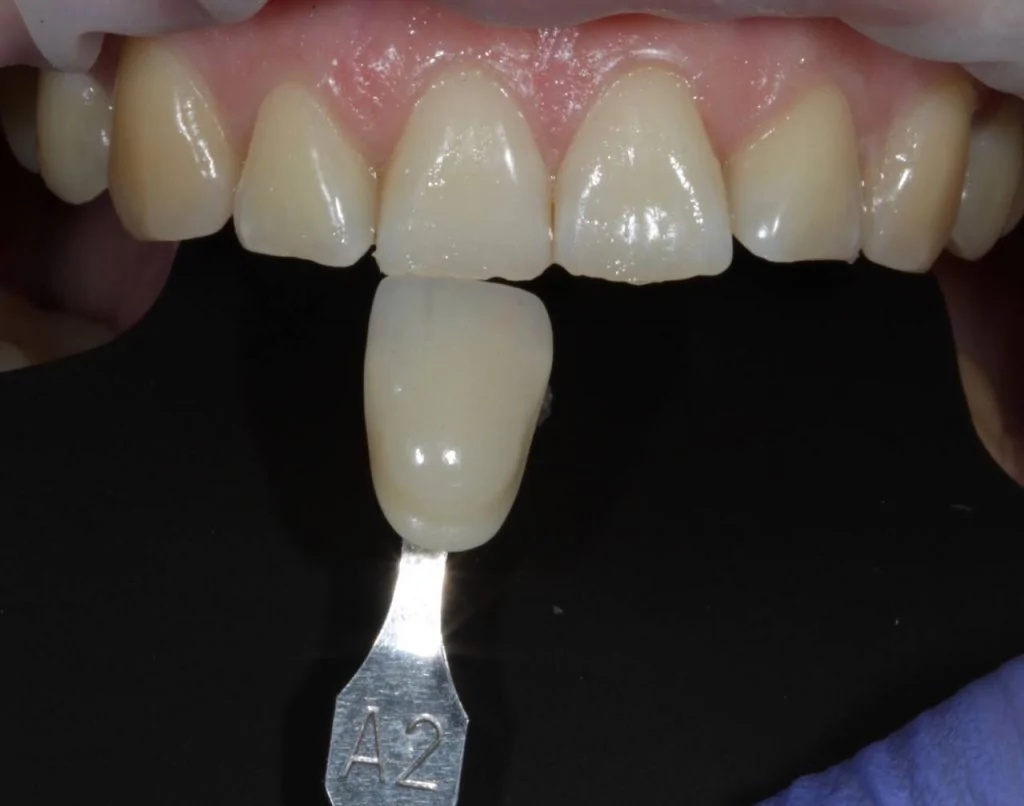 Портфолио - после 1