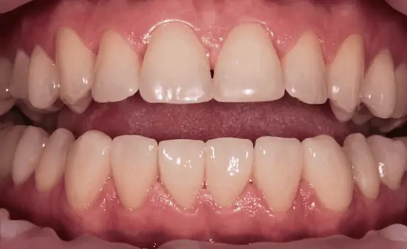 Портфолио - основное изображение