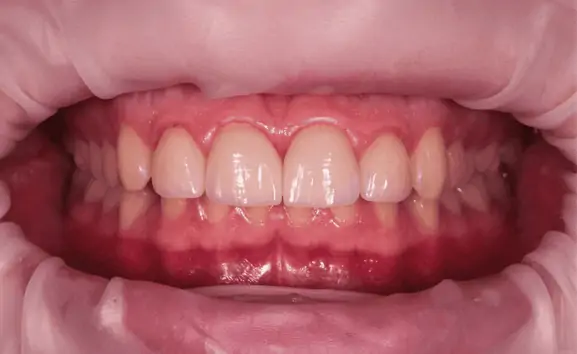 Портфолио - основное изображение